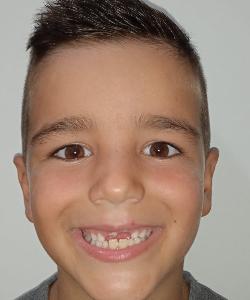 Lucas (C.D. La Salle D) - 2021/2022